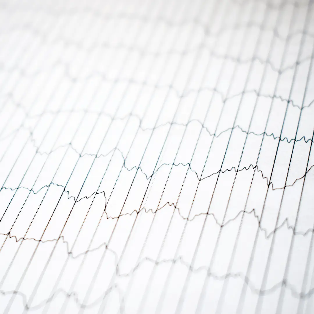 Detailed view of a graph with lines depicting Slow Wave Sleep EEG patterns.